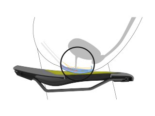 Position eines weiblichen Beckens im Querschnitt mit Darstellung der Nervenbahnen, Knochen und Weichteile, die die Entlastung eines Ergon-Sattels verdeutlicht.