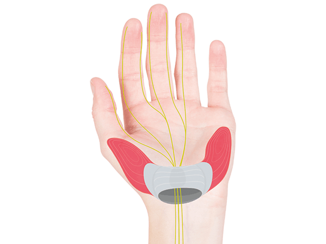 If the wrist is bent too much when biking, the carpal tunnel can be compressed.