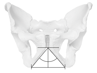 Male pelvis with steep pubic skids.