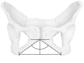 Female pelvis with large pubic angle.
