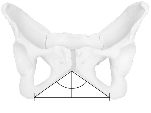 Female pelvis showing the wide angle of the pubic bone