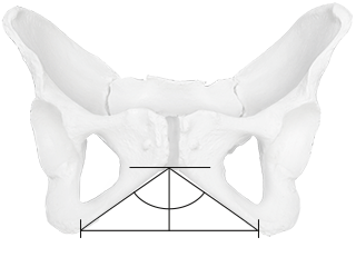 Front view, female pelvis with illustration of the pubic symphysis