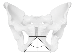 Front view, male pelvis with illustration of the pubic symphysis