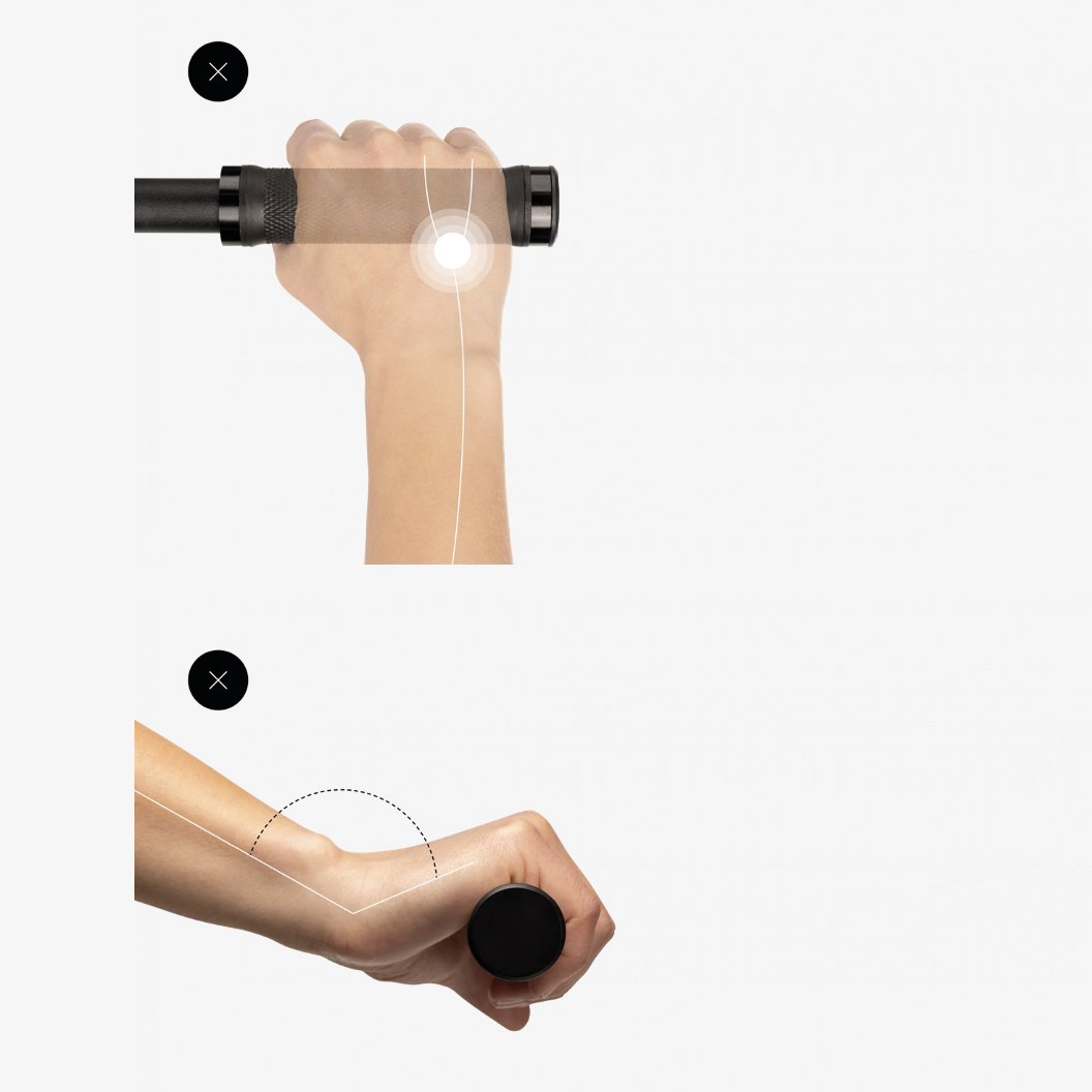 Ergon GP1 Ulnarnerv und Karpaltunnel Problem