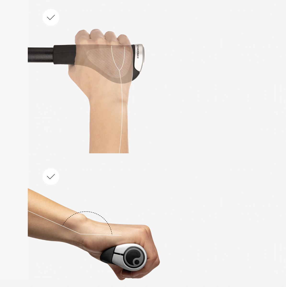 Ergon GP1 Ulnarnerv und Karpaltunnel Lösung