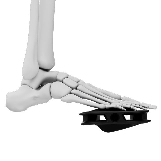 Abbildung eines Fußskeletts auf einem Pedal