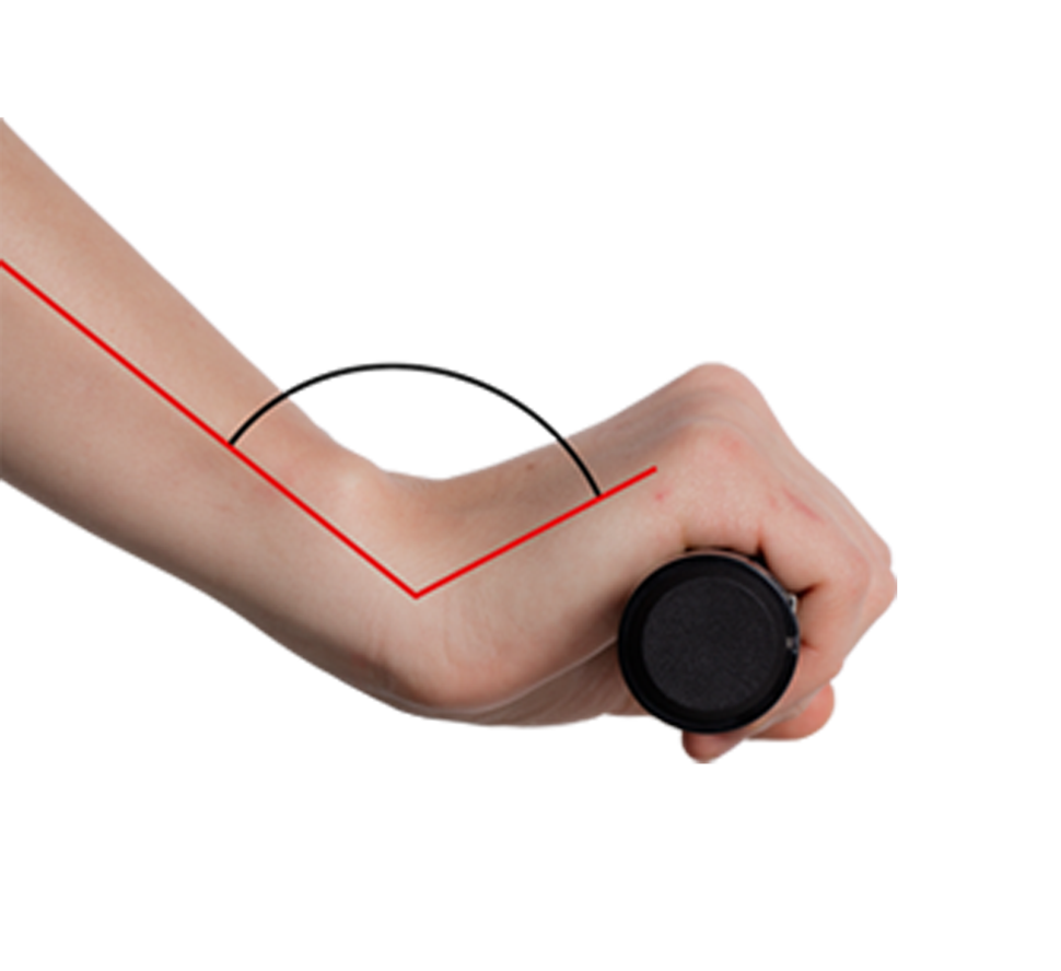 Schematic illustration of a hand gripping a standard MTB grip without wings. The wrist is strongly bent. The carpal tunnel nerve is pinched – shown in red.